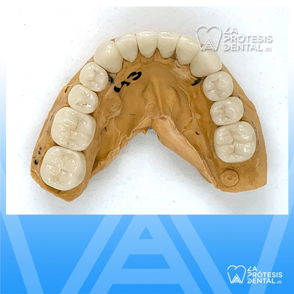 la-protesis-dental-0903